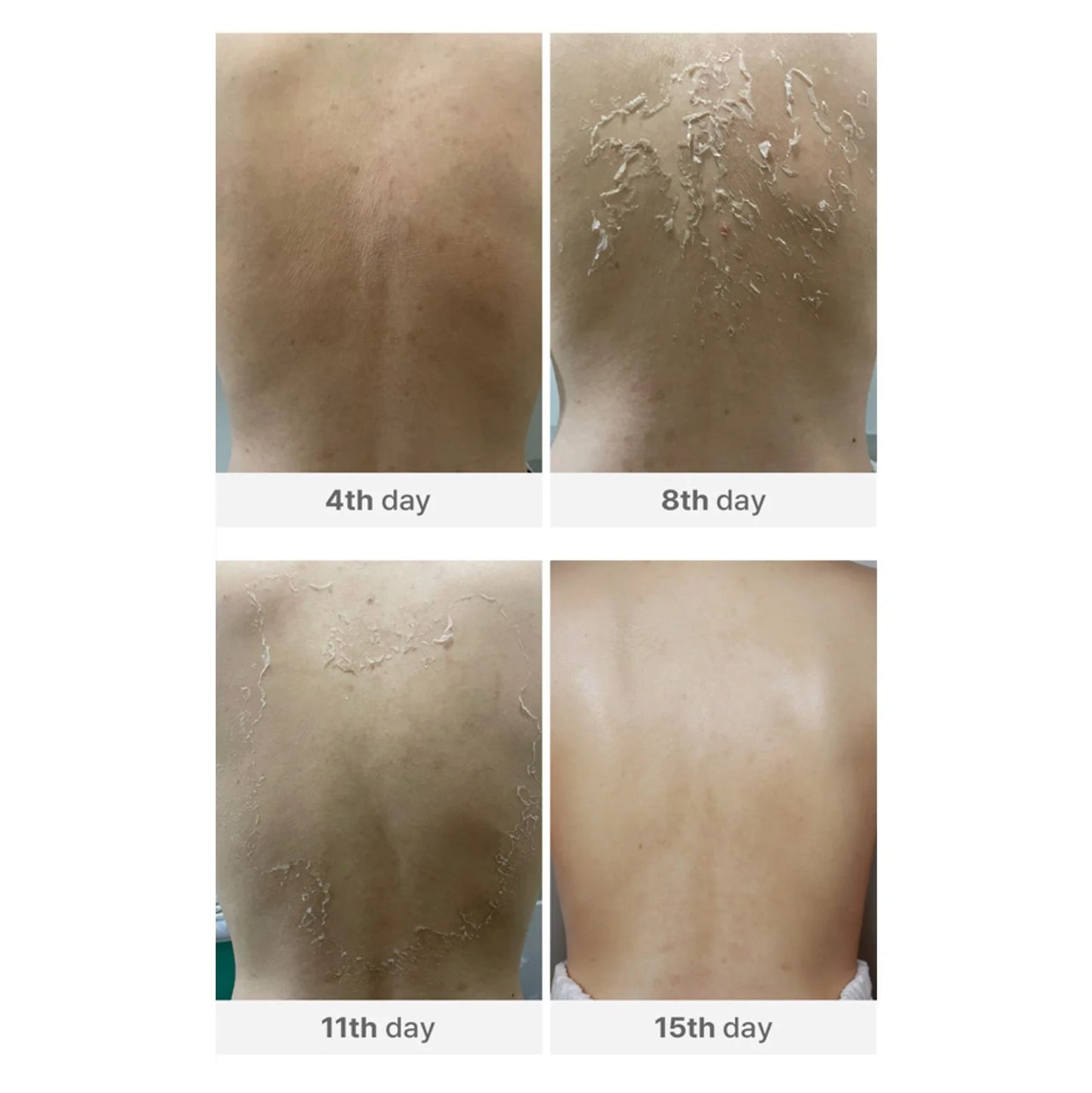 Medisco Peelieve Peeling 5x1g + 5x8ml