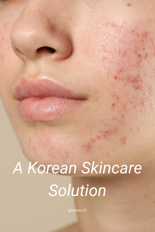 Acne with Lesimo: A Korean skincare solution