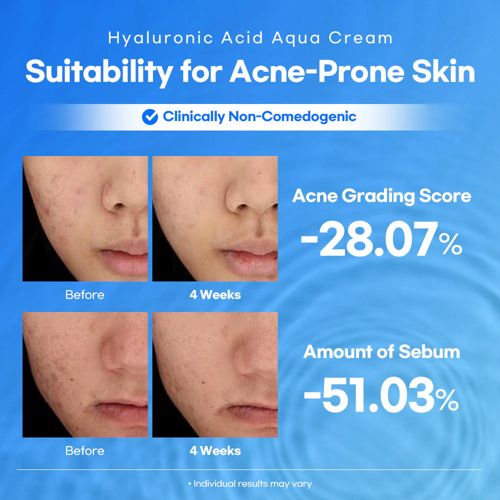 Lesimo Moisturizer Hyaluronic Acid Aqua Cream lightweight 100ml